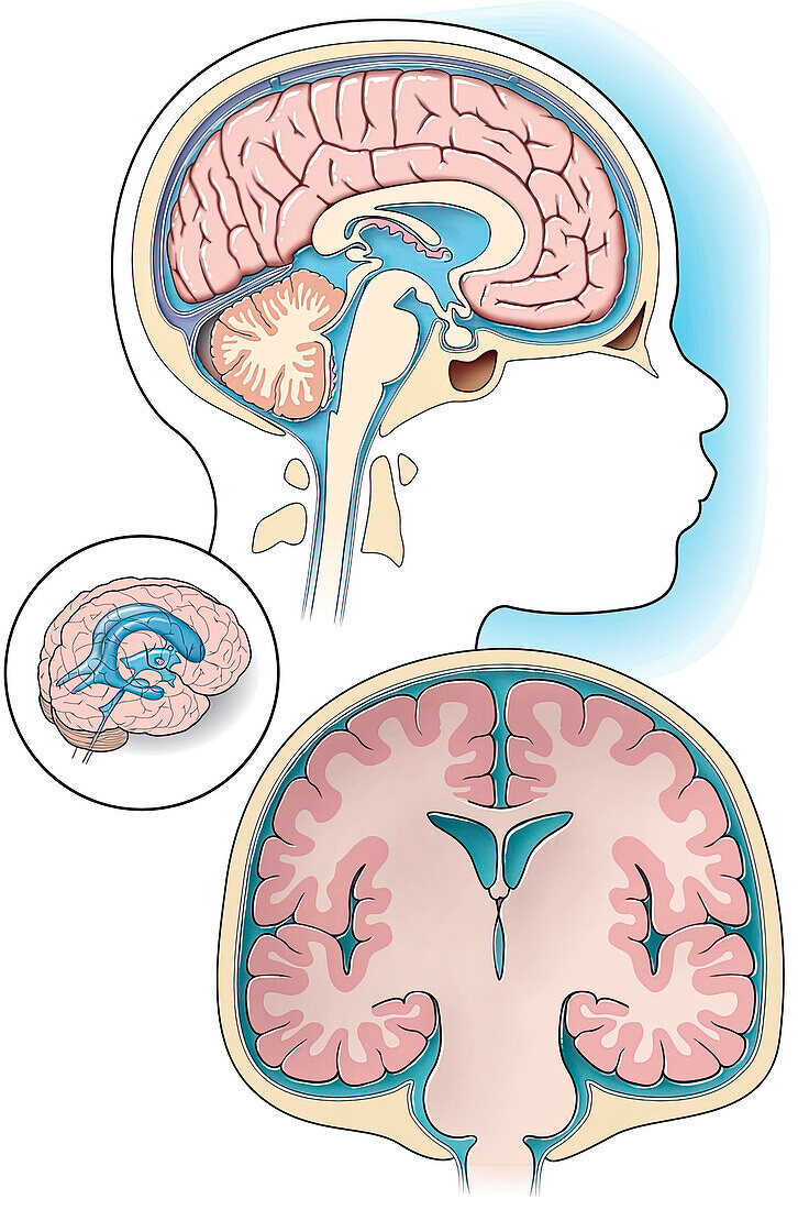 Normal anatomy of the ventricles, illustration