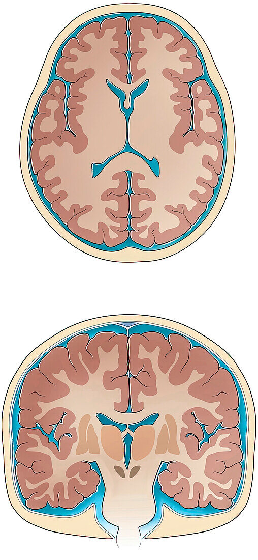 Normal coronal and cross-sections of brain, illustration
