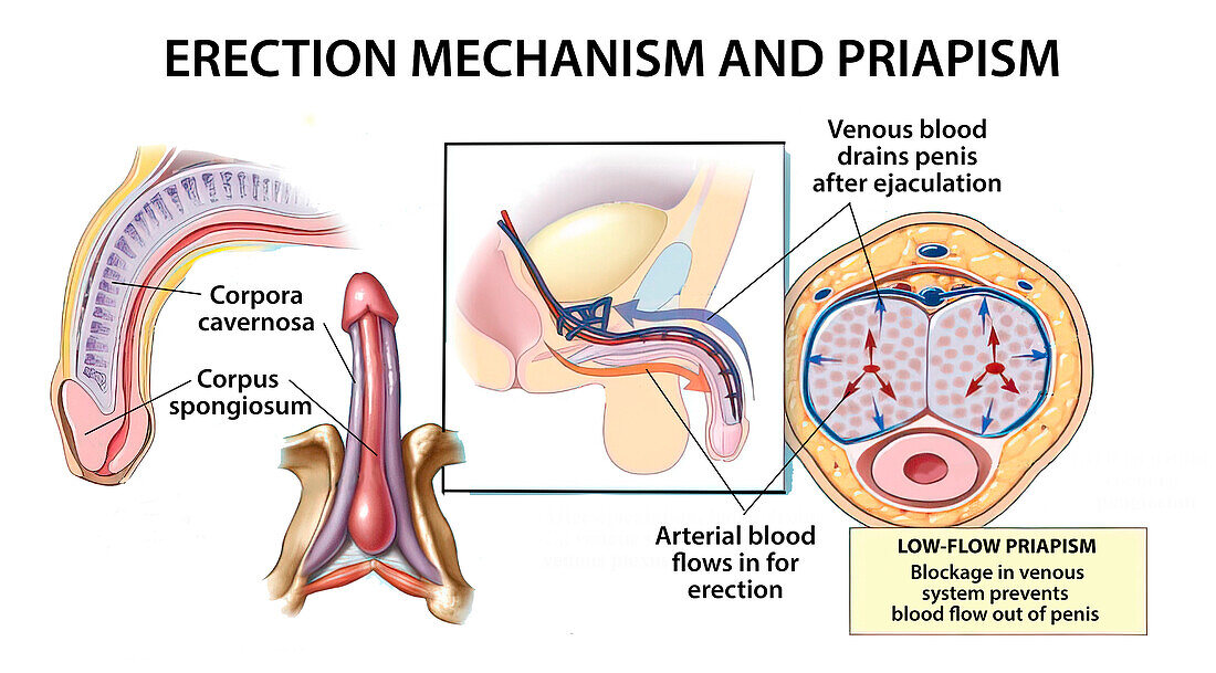 Erection and priapism, illustration