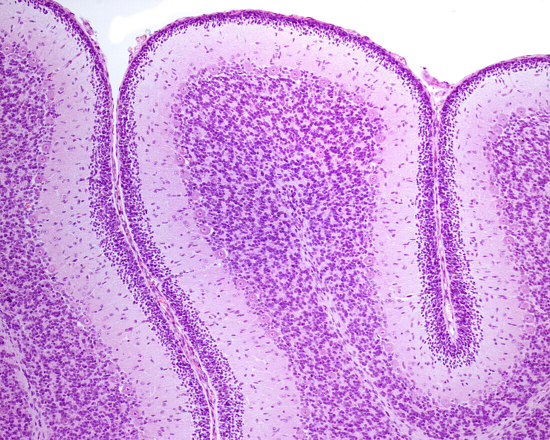 Immature cerebellum, light micrograph