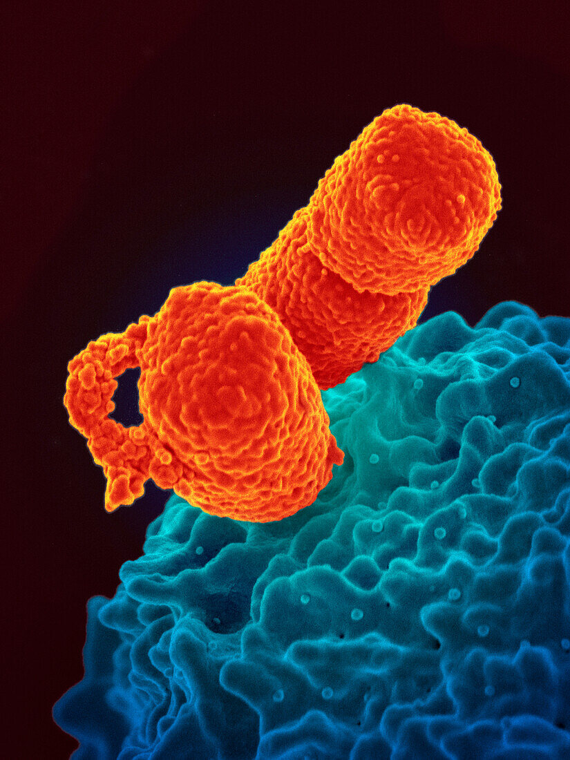 White blood cell interacting with Klebsiella pneumoniae bacteria, SEM