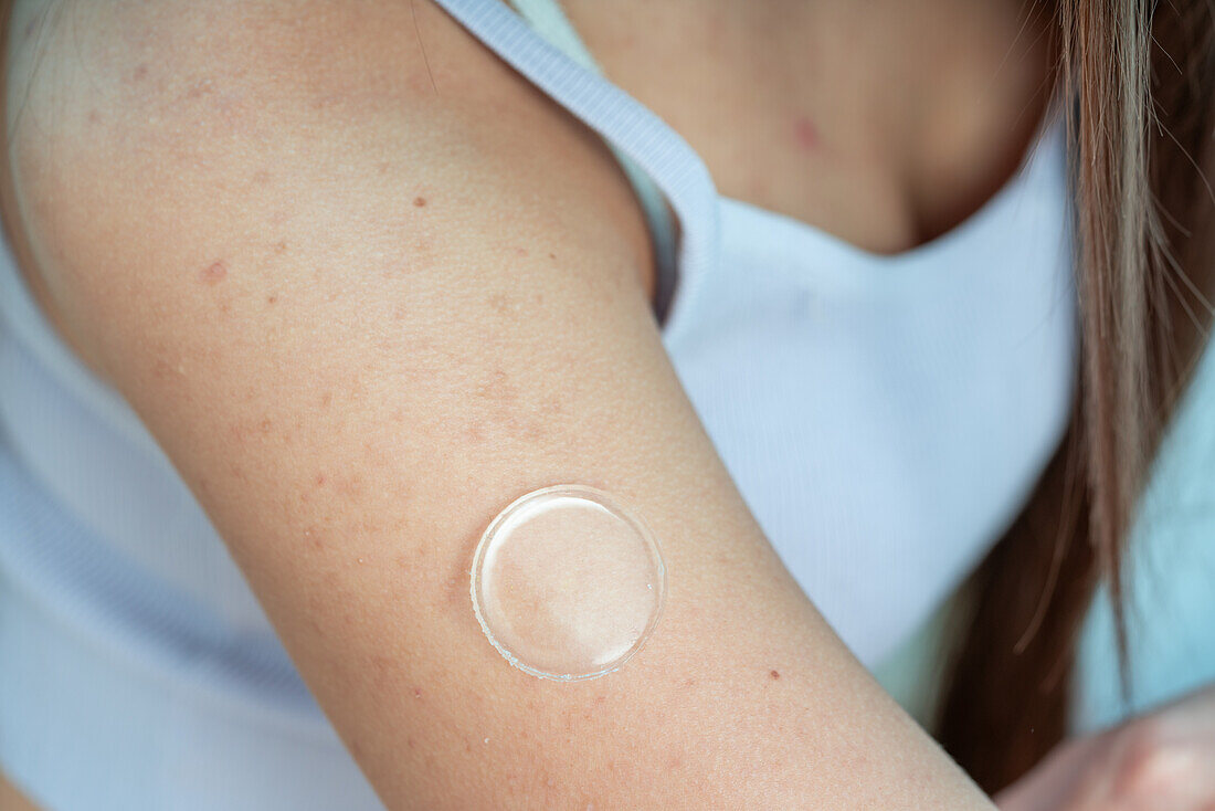 Person applying microneedle patch to arm