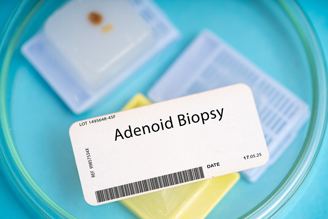 Adenoid biopsy