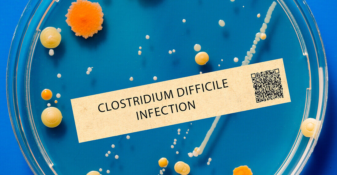 Clostridium difficile infection