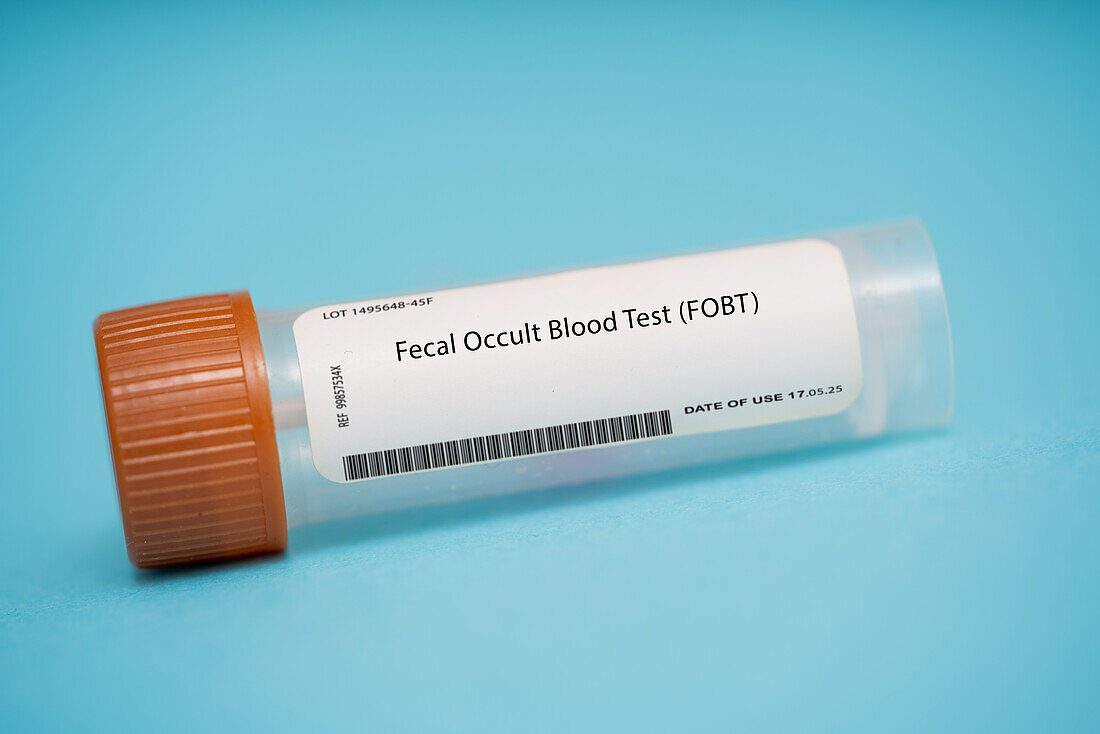Faecal occult blood test