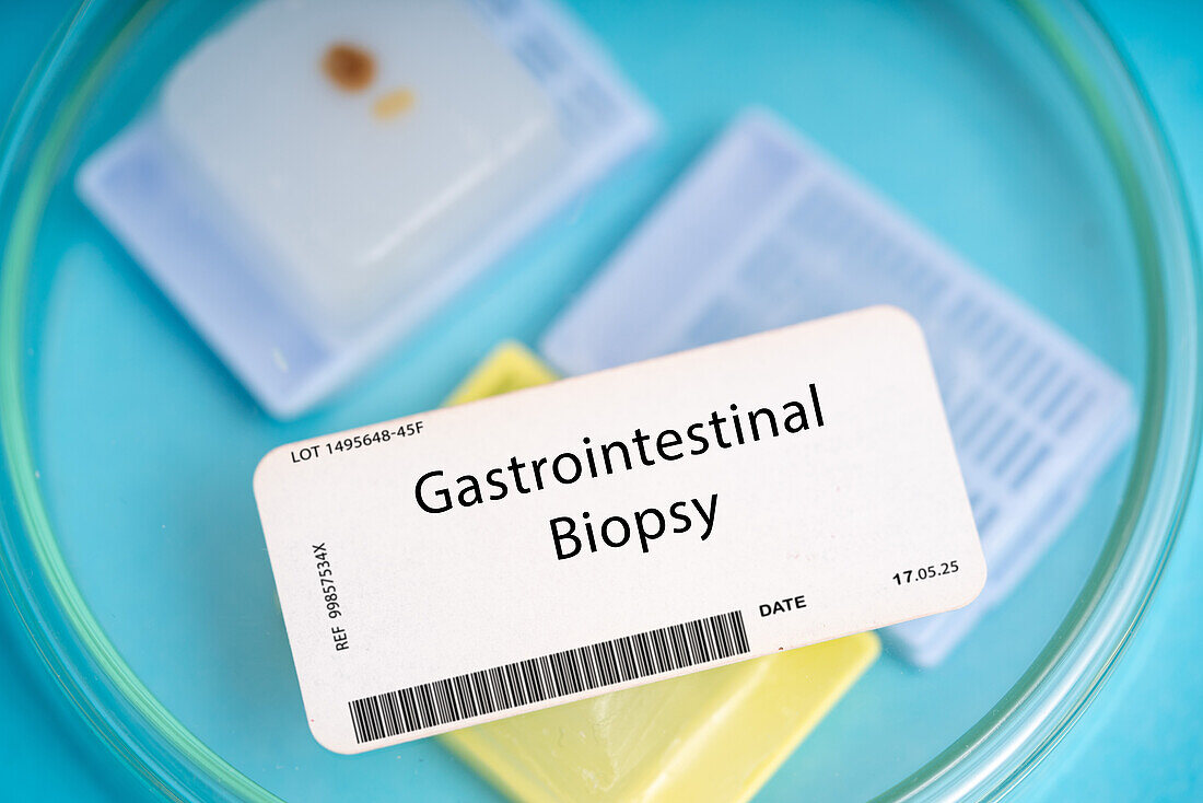 Gastrointestinal biopsy