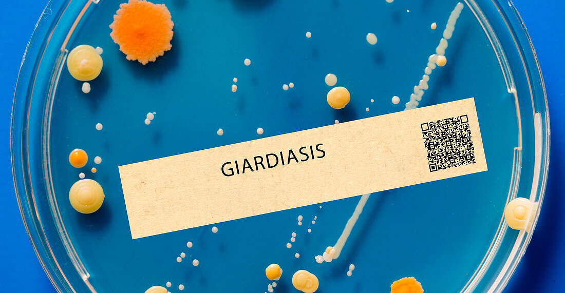 Giardiasis parasitic infection