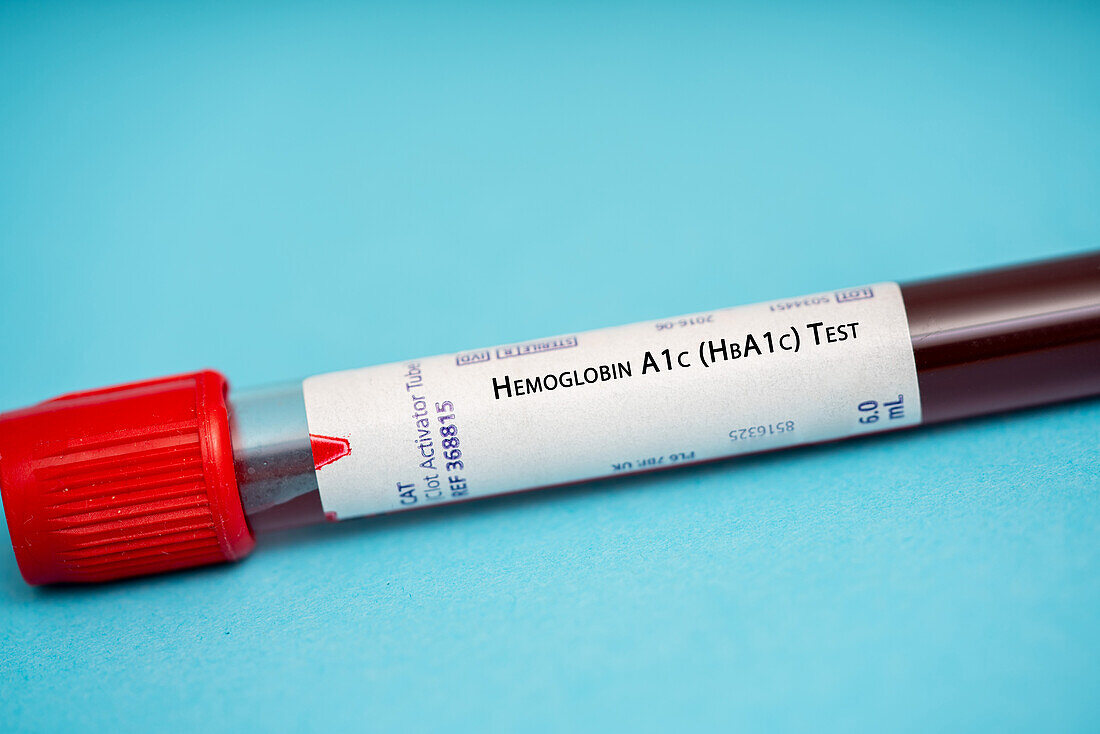 Haemoglobin A1c test