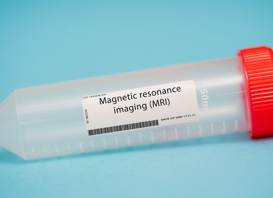 Magnetic resonance imaging