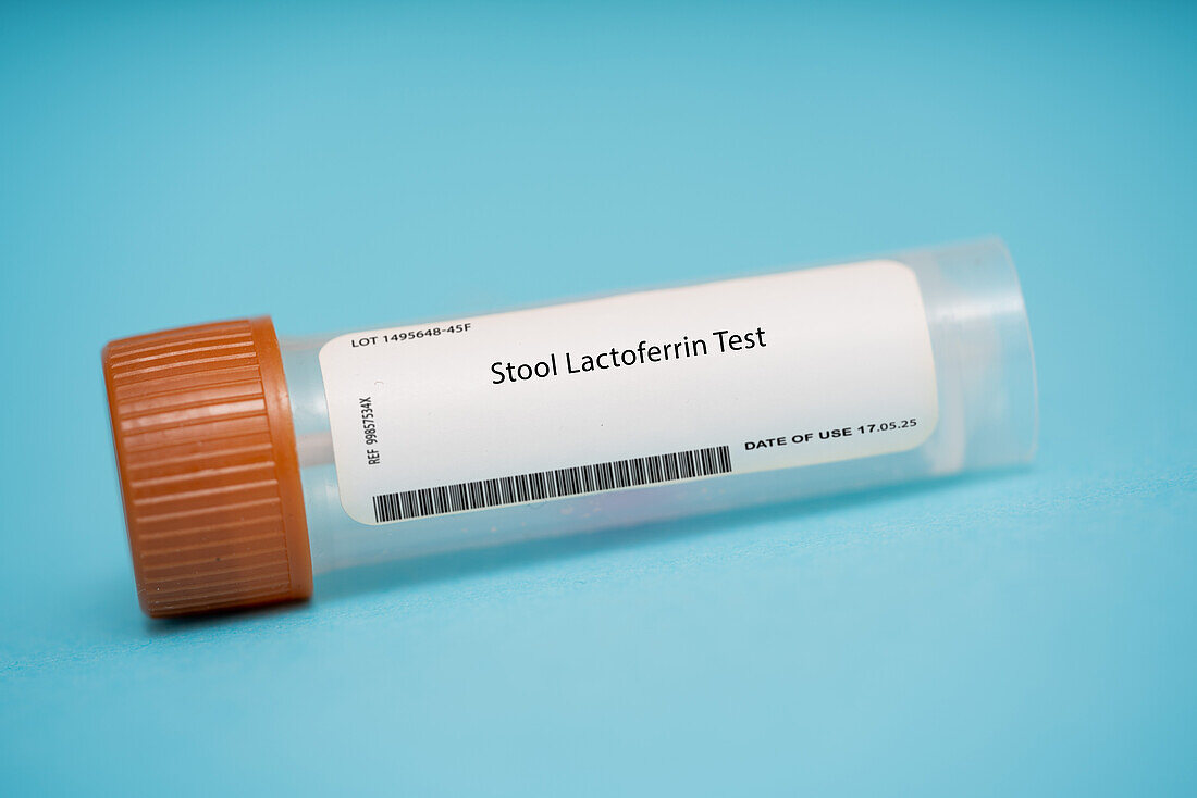 Stool lactoferrin test