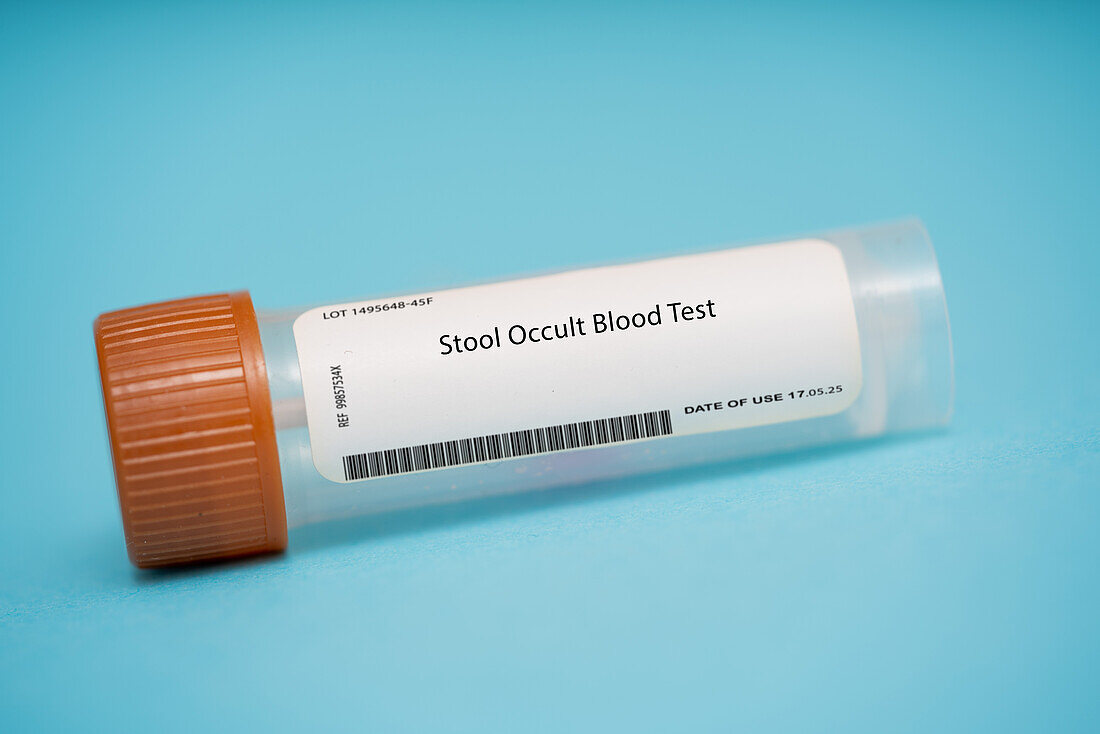 Stool occult blood test
