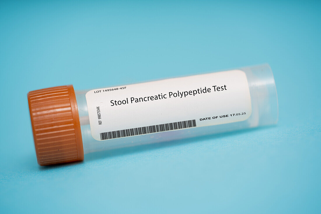 Stool pancreatic polypeptide test