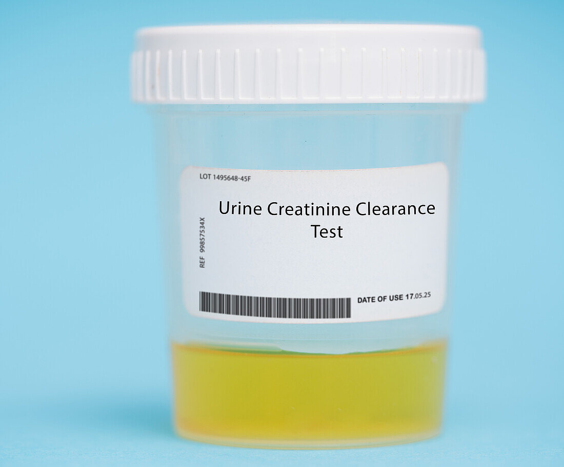 Urine creatinine clearance test