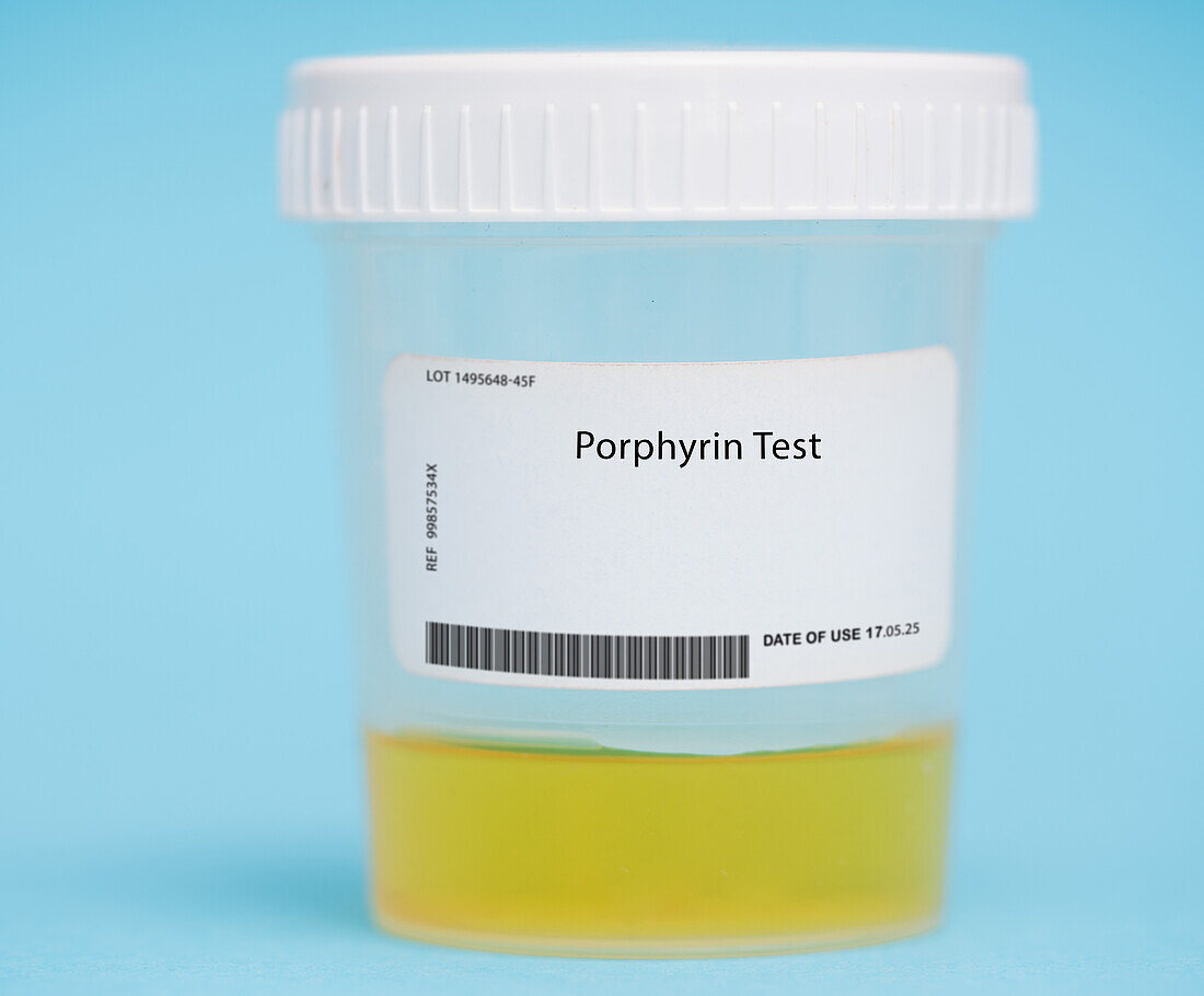 Porphyrin test