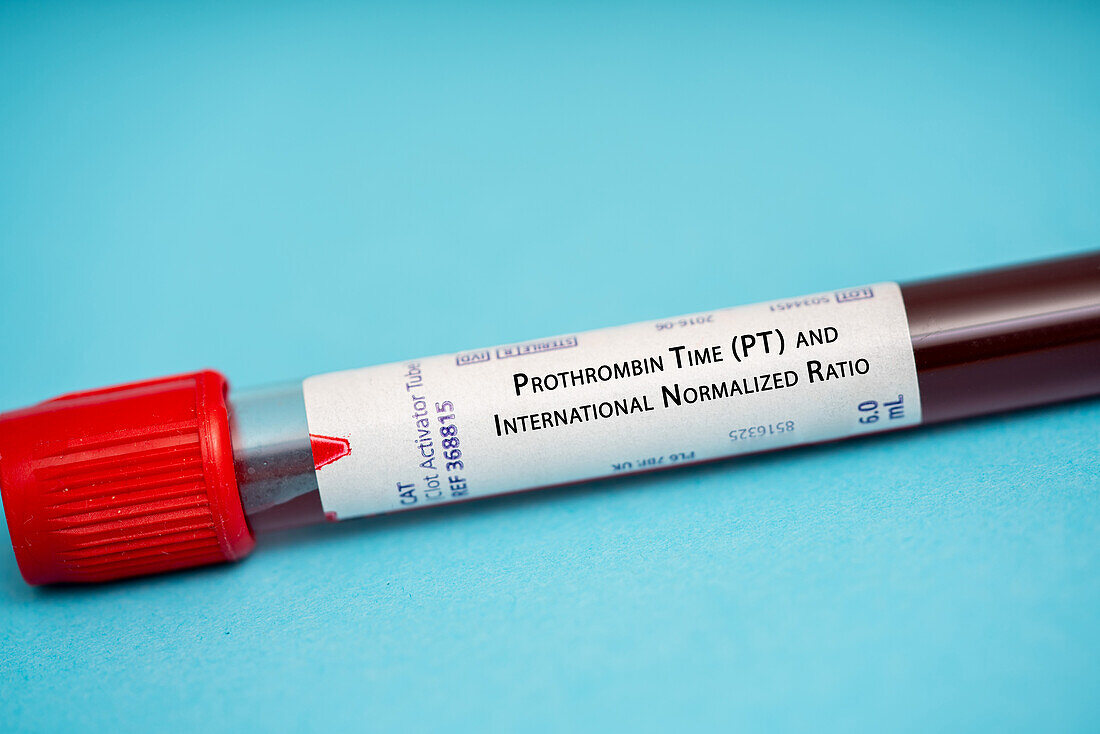 Prothrombin time and international normalized ratio test