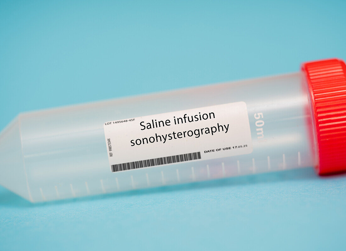 Saline infusion sonohysterography