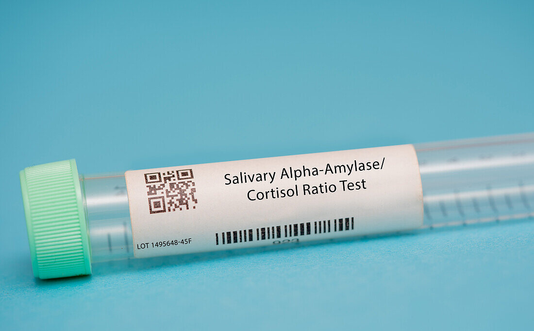 Salivary alpha-amylase/cortisol ratio test