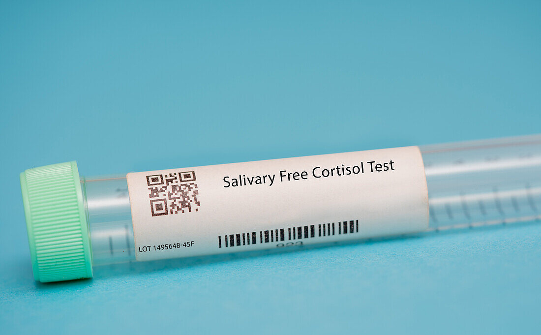 Salivary free cortisol test