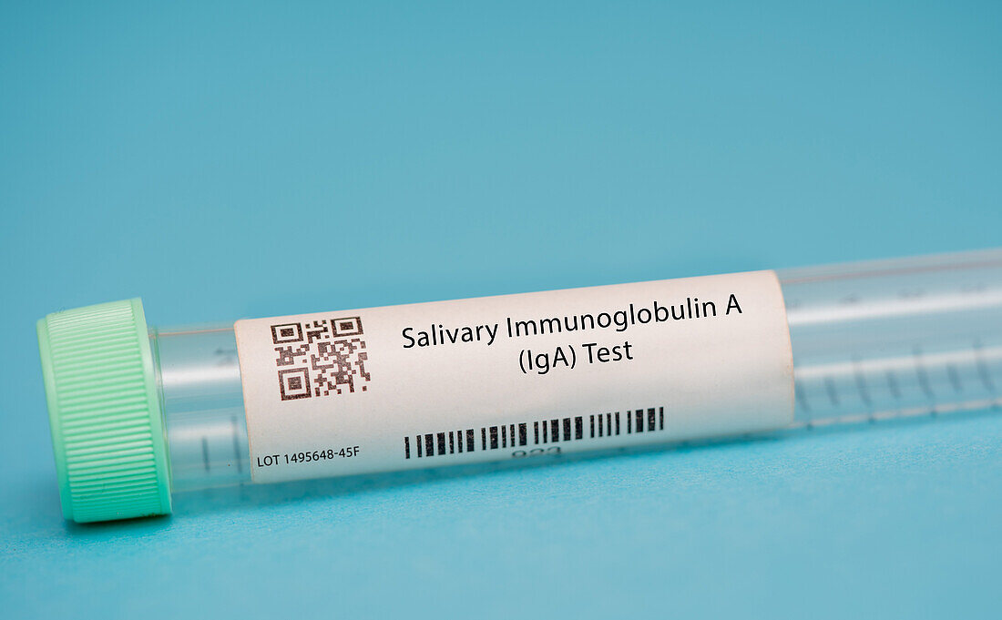 Salivary immunoglobulin A test