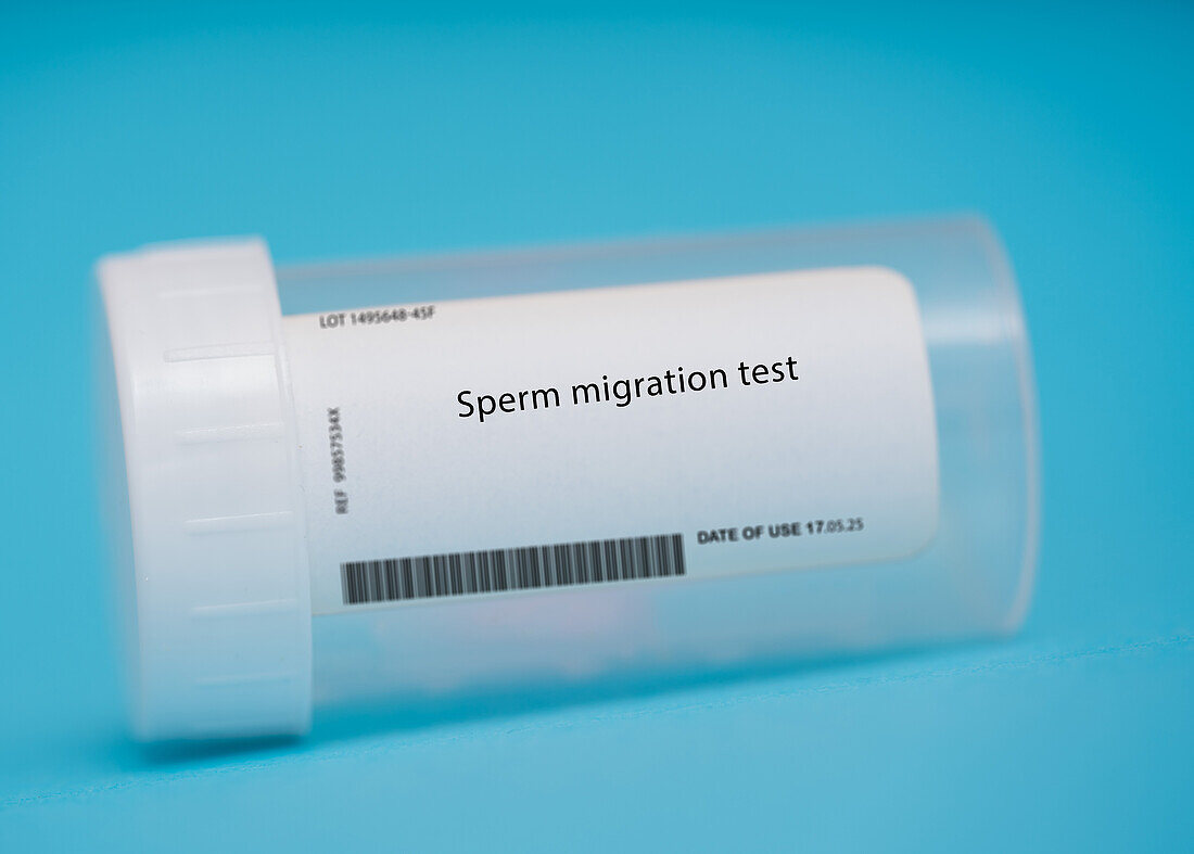 Sperm migration test