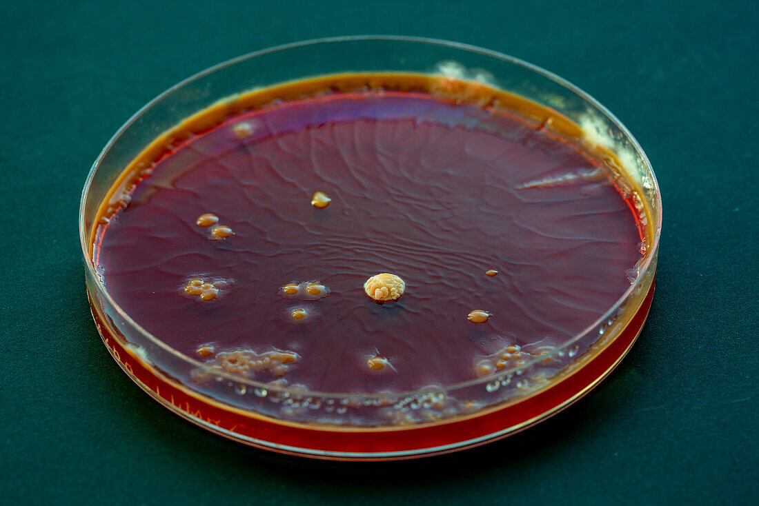 Microorganisms in petri dish