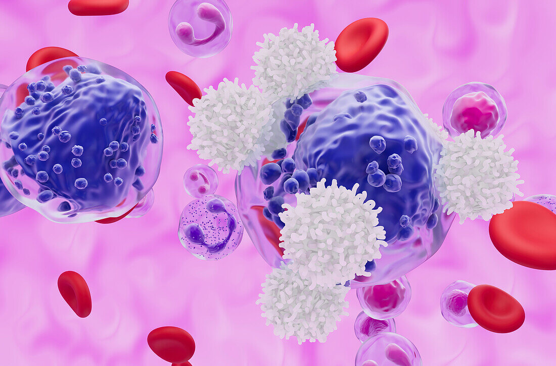 T cells attacking acute myeloid leukaemia cell, illustration