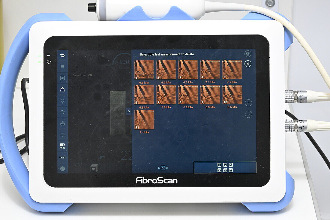 Fibroscan diagnostic device