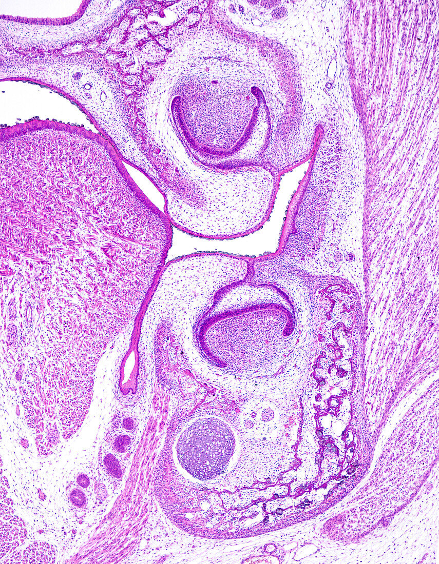Rat embryo head, light micrograph
