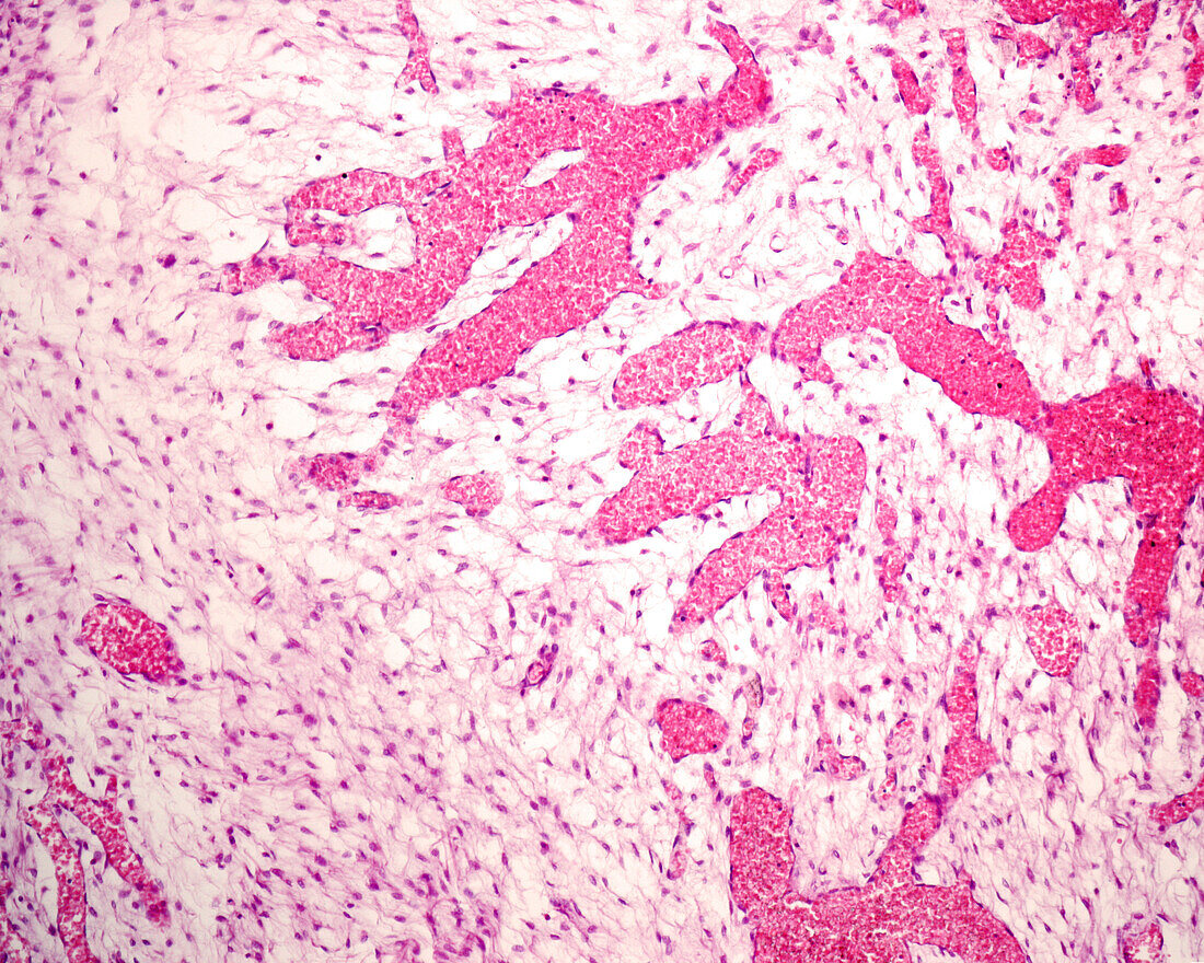 Developing blood vessels, light micrograph