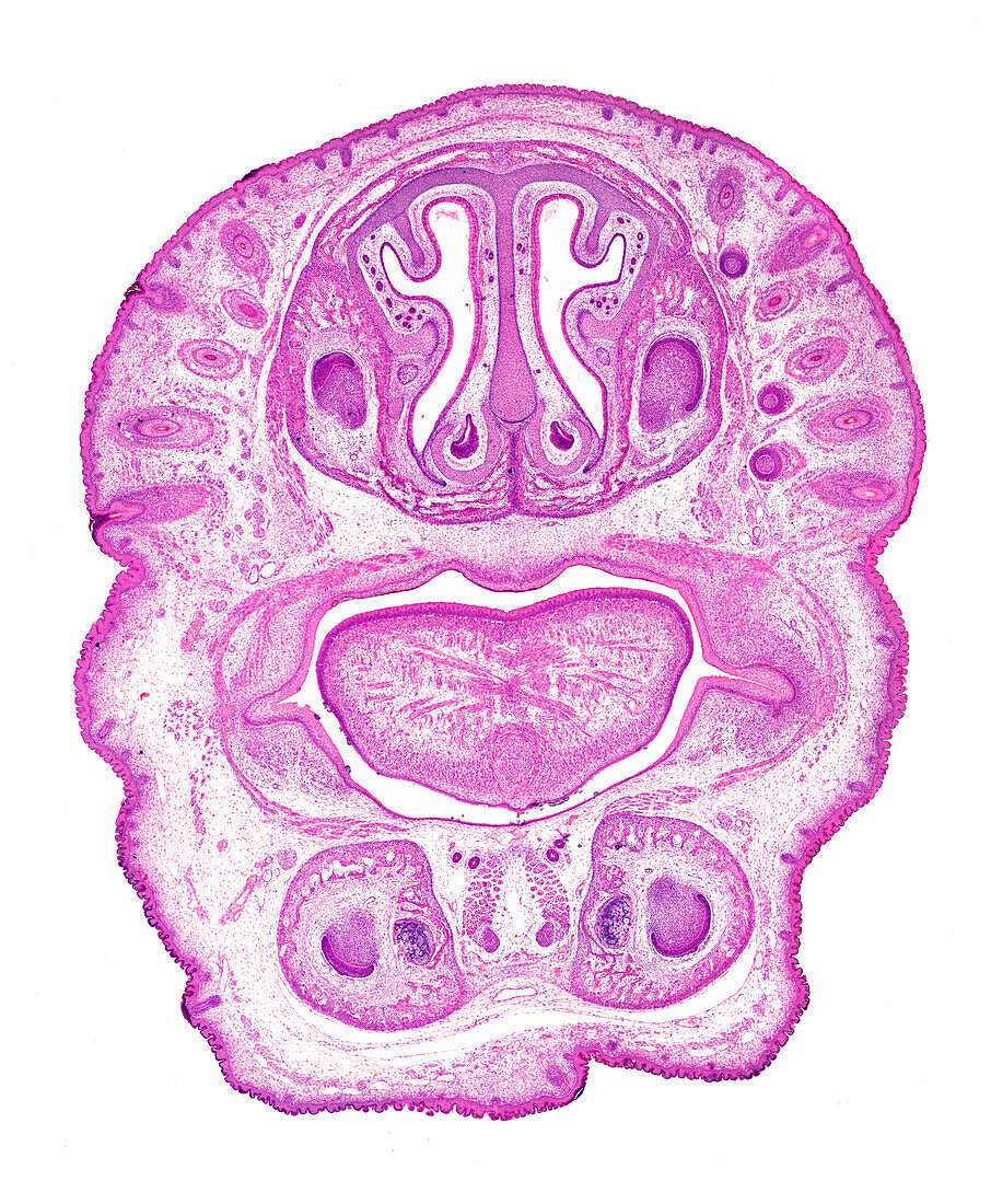 Frontal section of embryoâ€™s head, light micrograph