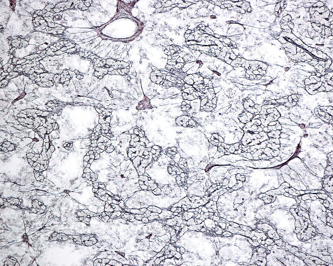 Lymph node medulla, light micrograph