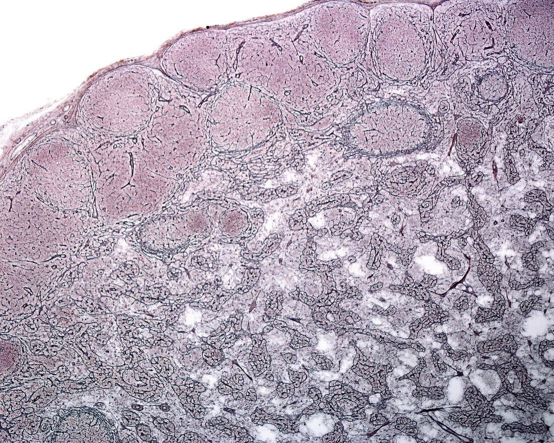 Lymph node reticular fibres, light micrograph