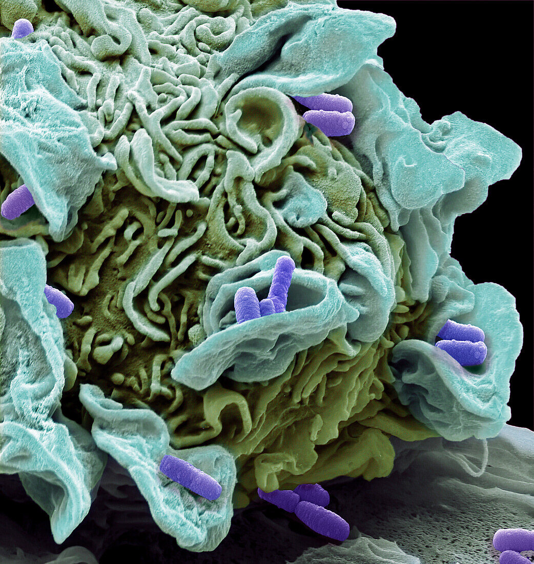 Macrophage engulfing e.coli bacteria, SEM