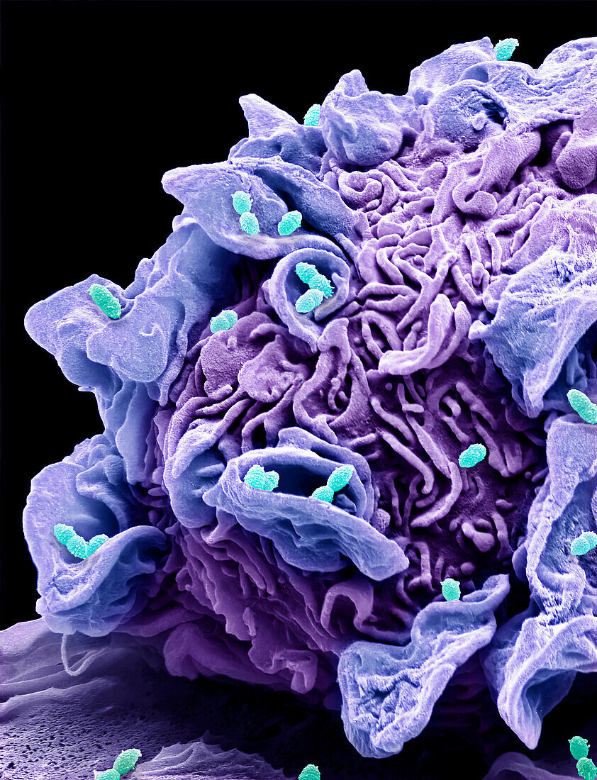 Macrophage engulfing streptococcus, SEM