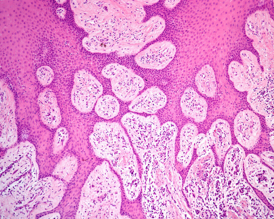 Human gingiva epithelium, light micrograph