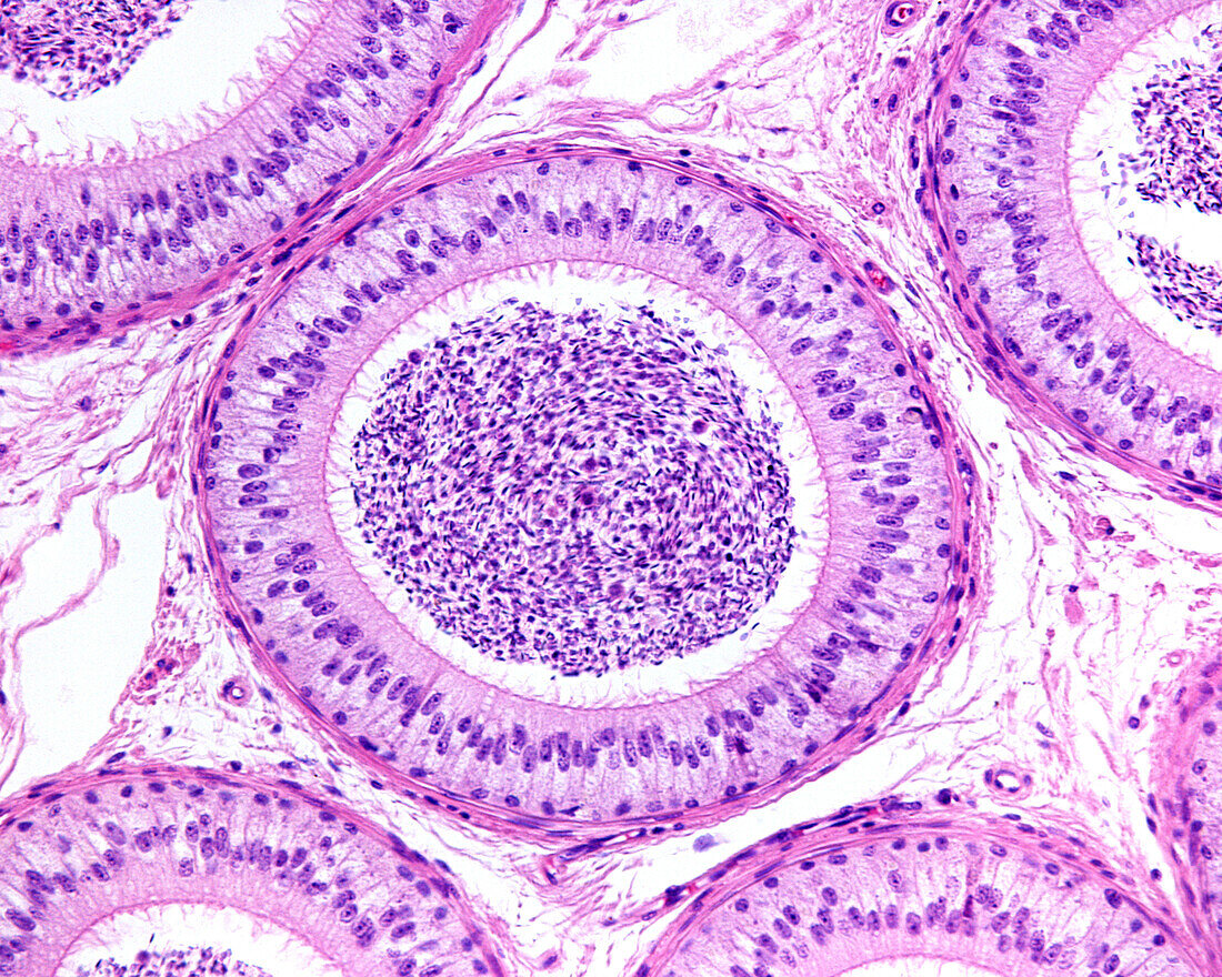 Epididymis pseudostratified epithelium, light micrograph