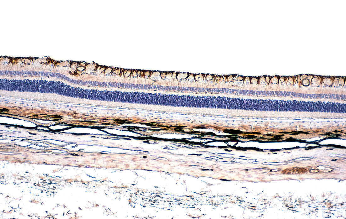 Retinal Muller cells, light micrograph