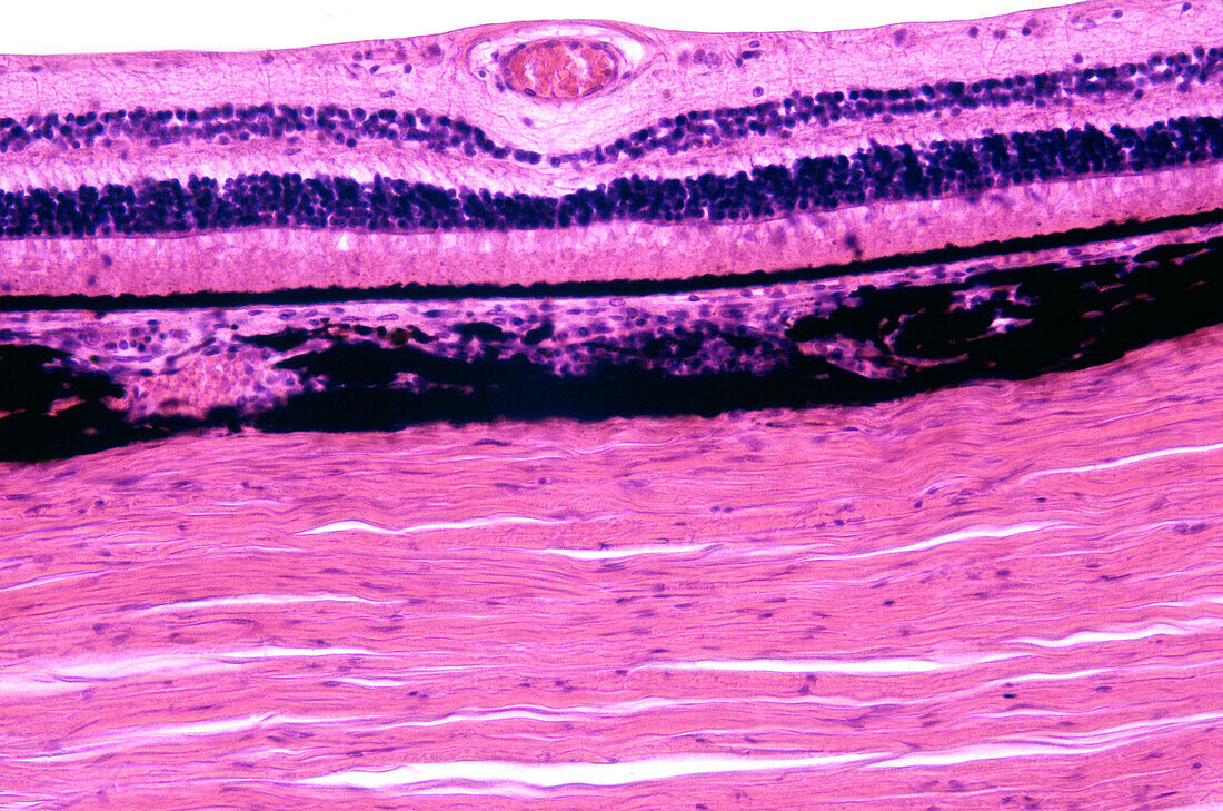 Human eyeball layers, light micrograph