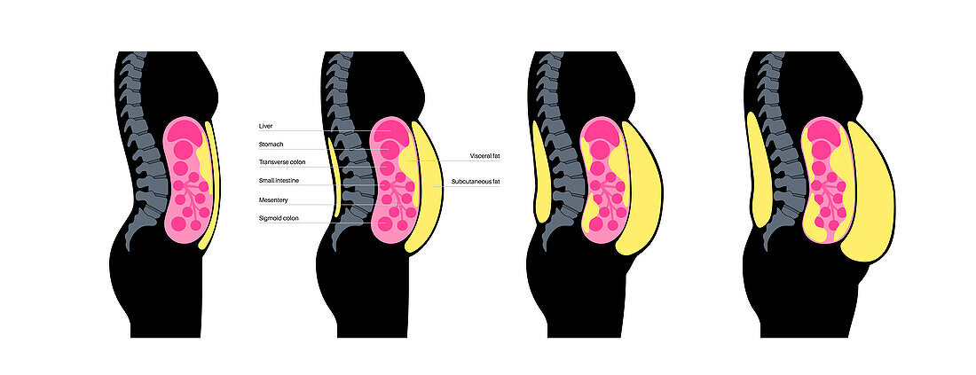 Visceral fat diagram, illustration