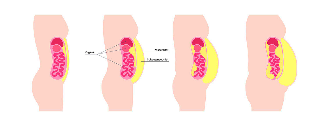 Visceral fat diagram, illustration