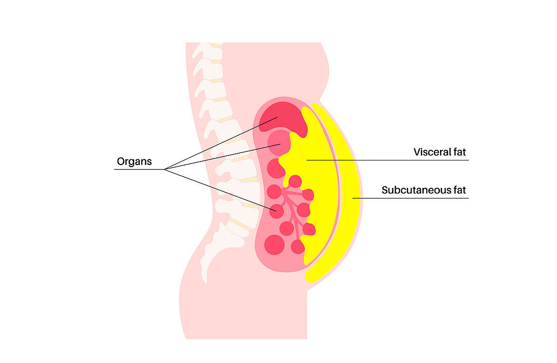 Visceral fat diagram, illustration