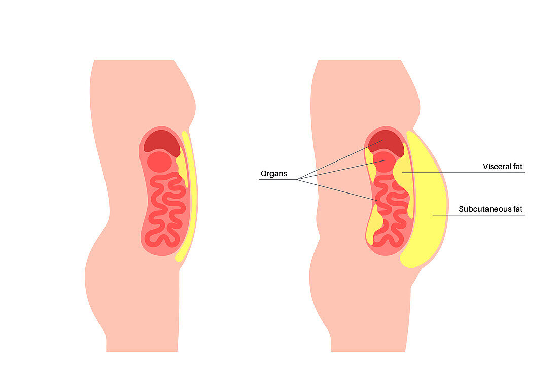 Visceral fat diagram, illustration