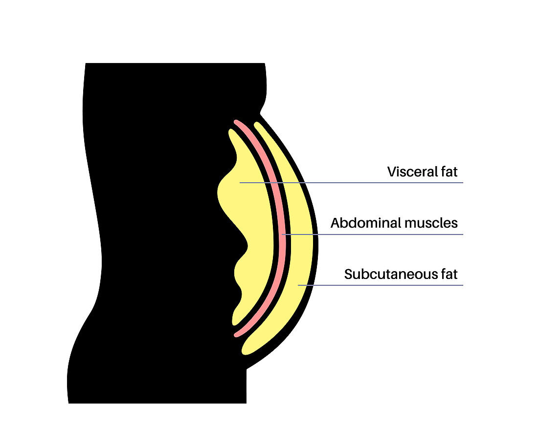 Visceral fat diagram, illustration