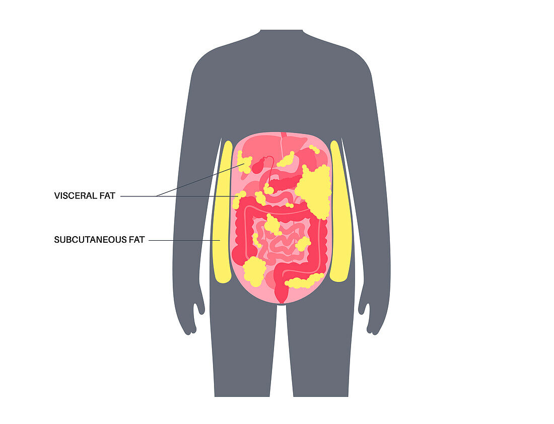 Visceral fat diagram, illustration