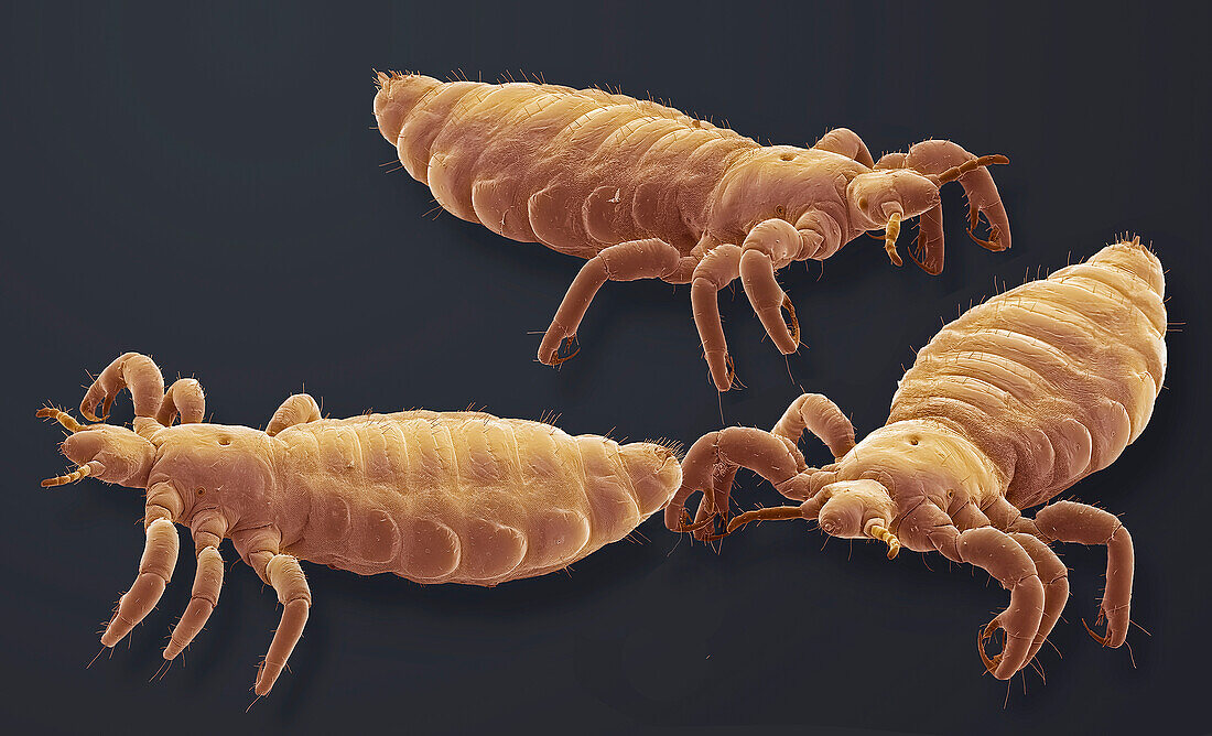 Head lice, SEM