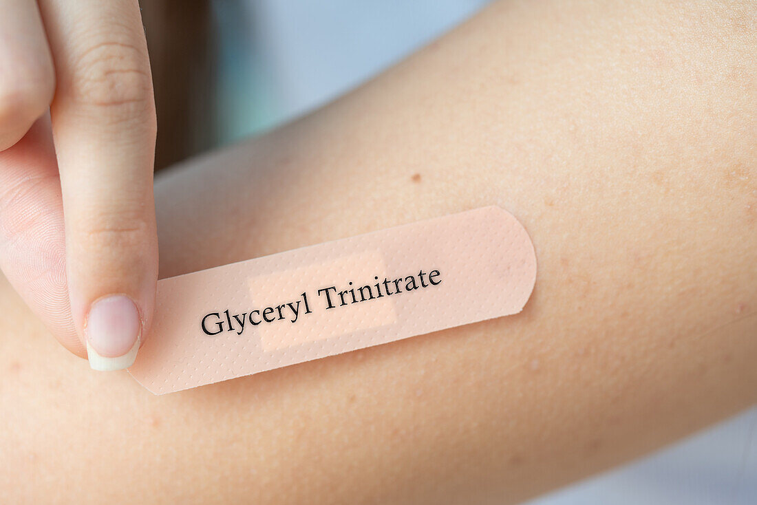 Glyceryl trinitrate transdermal patch, conceptual image