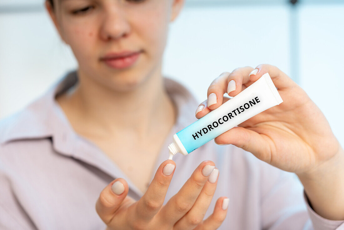 Hydrocortisone medical cream, conceptual image
