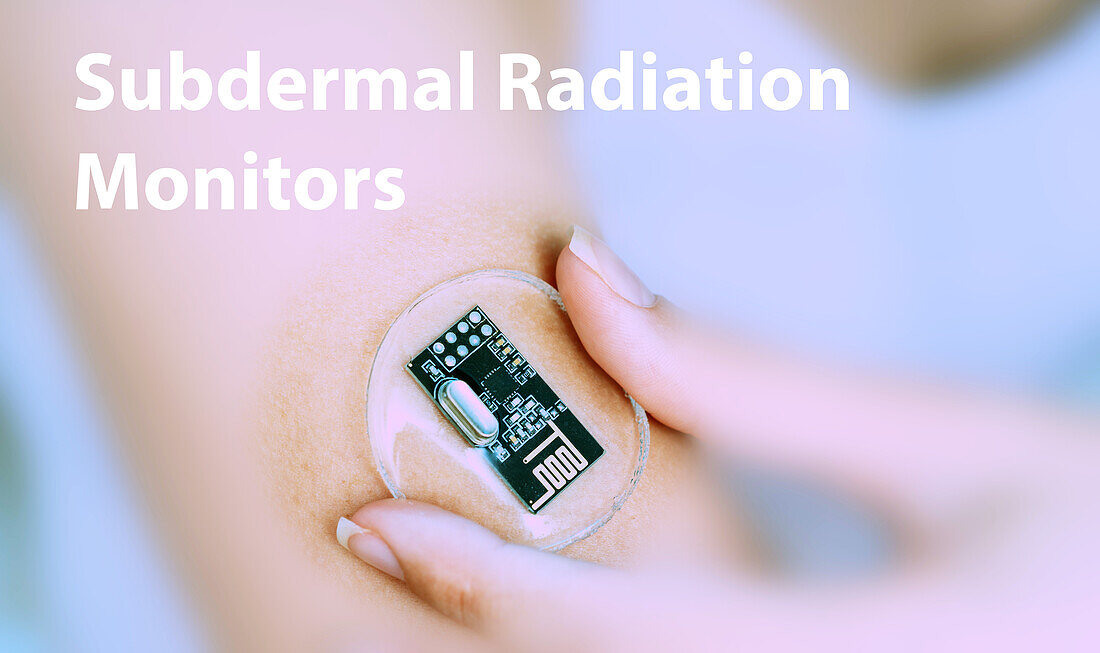 Subdermal radiation monitors, conceptual image