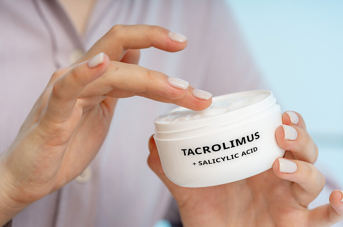 Tacrolimus and salicylic acid medical cream, conceptual image