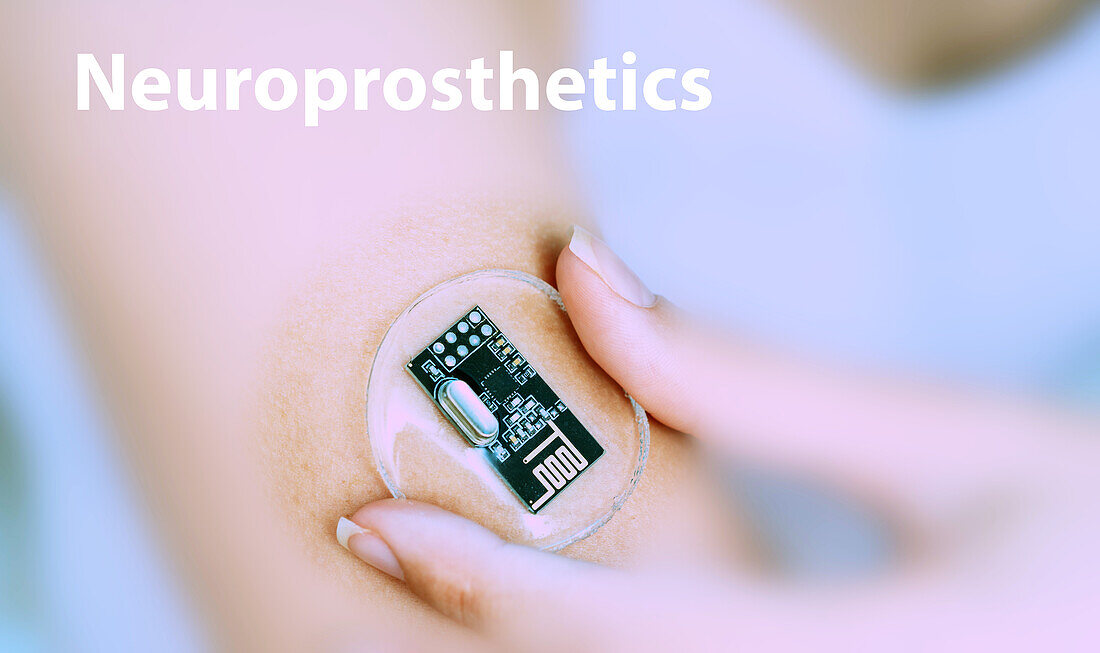 Neuroprosthetics implantable device, conceptual image